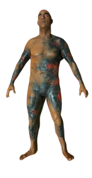 Burn Wound Ben Body Prop