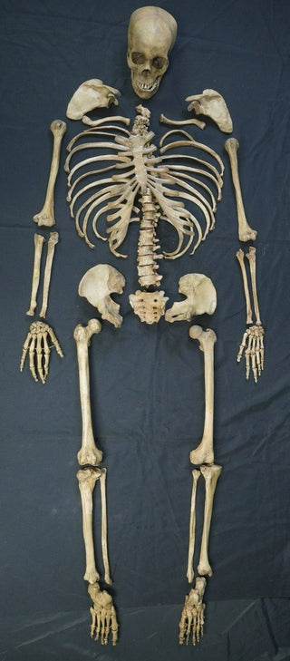 Disarticulated Skeleton with Cast Skull