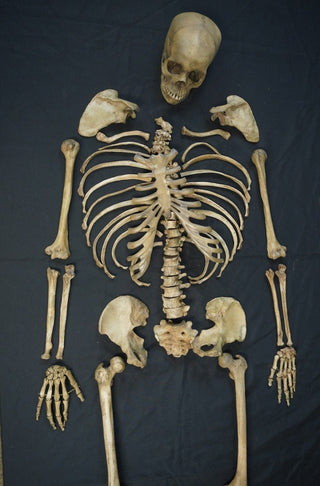 Disarticulated Skeleton with Cast Skull