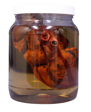 Replica Specimen Jar, Human Heart