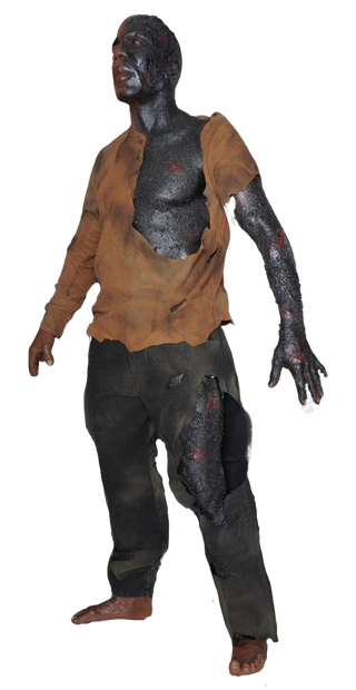 Burn Wound Richard Body