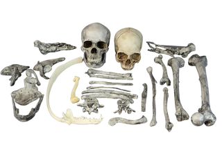 Deluxe Skull and Bones Assortment 25 pcs