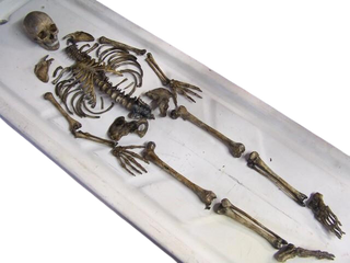 Disarticulated Skeleton with Cast Skull