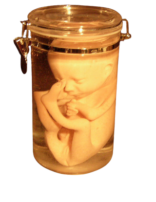 Fetus Replica 7 Month in 64 oz jar