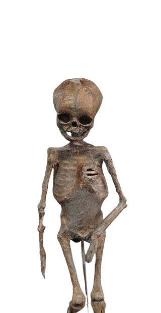 Mummified Infant