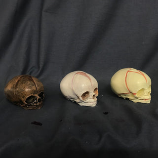 Cast Fetal Skull