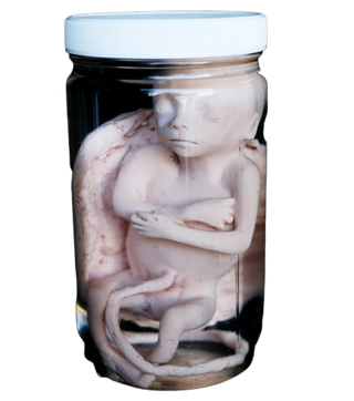 Fetus Replica at 5 months in Specimen Jar
