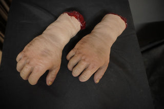 Swollen Hand