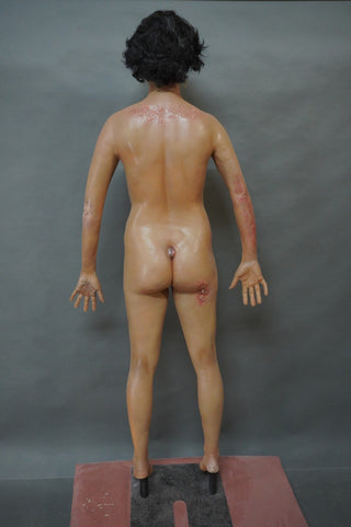 Dura Dermatology Jessica Standing Body
