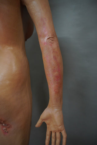 Dura Dermatology Jessica Standing Body