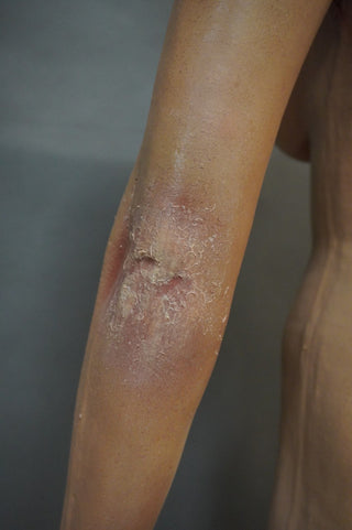 Dura Dermatology Jessica Standing Body