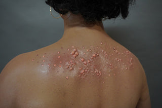 Dura Dermatology Jessica Standing Body