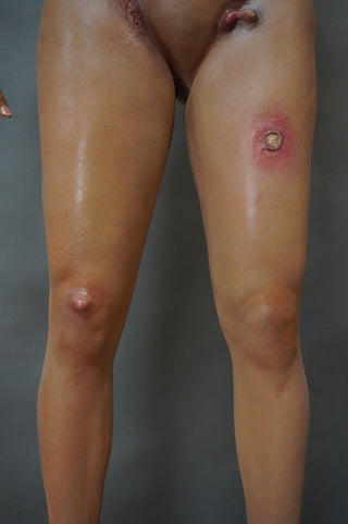 Dura Dermatology Jessica Standing Body