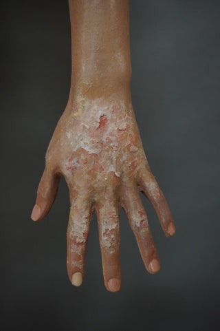 Dura Dermatology Jessica Standing Body
