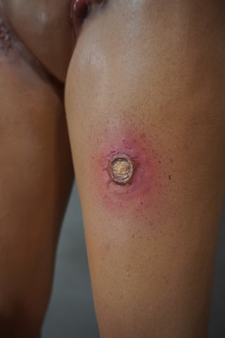 Dura Dermatology Jessica Standing Body
