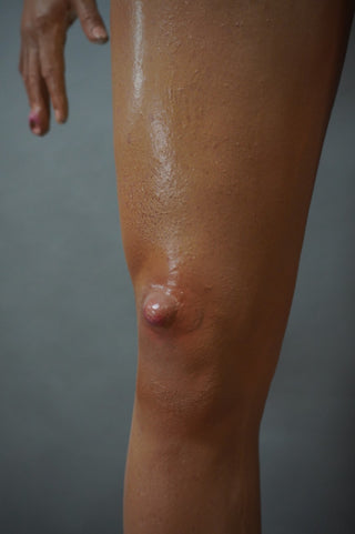Dura Dermatology Jessica Standing Body