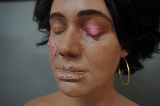 Dura Dermatology Jessica Standing Body