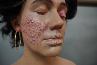 Dura Dermatology Jessica Standing Body