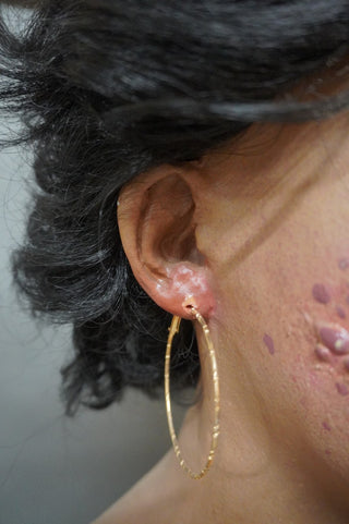 Dura Dermatology Jessica Standing Body