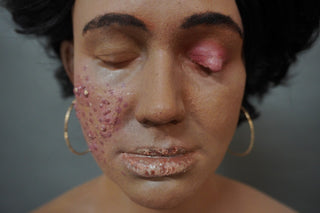 Dura Dermatology Jessica Standing Body