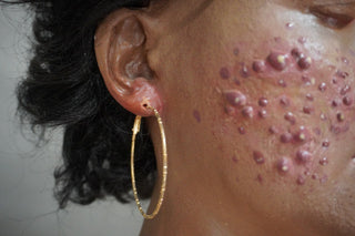 Dura Dermatology Jessica Standing Body