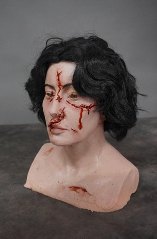 ER Lacerations Alexis Head
