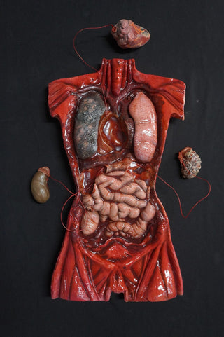 Diseased Organ Plate