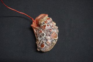 Diseased Organ Plate