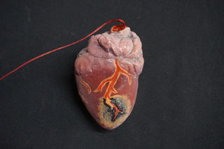 Diseased Organ Plate