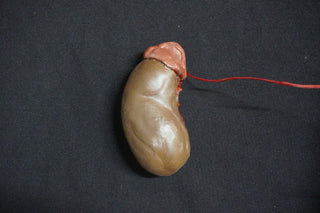 Diseased Organ Plate
