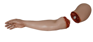 Amputation Nate Arm
