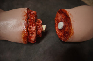 Amputation Nate Arm