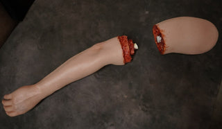 Amputation Nate Arm