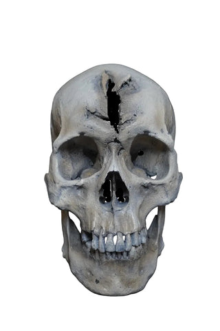 Sharp Force Trauma Forensic Skull