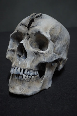 Sharp Force Trauma Forensic Skull