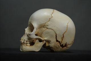 Toddler Forensic Skull with Pediatric Abuse Fractures