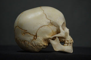 Toddler Forensic Skull with Pediatric Abuse Fractures