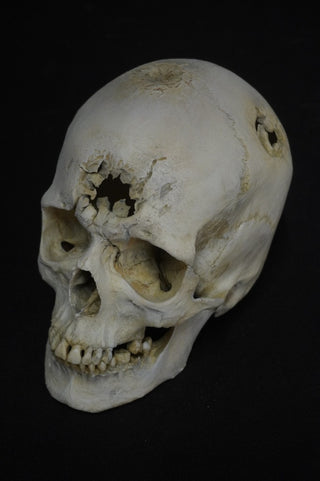 Blunt Force Trauma Lifecast Female Skull