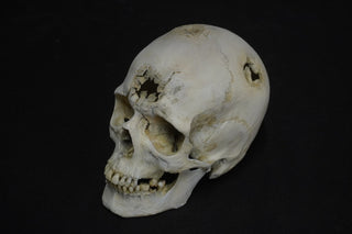 Blunt Force Trauma Lifecast Female Skull