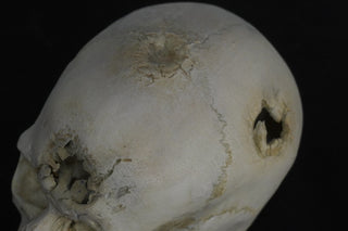 Blunt Force Trauma Lifecast Female Skull