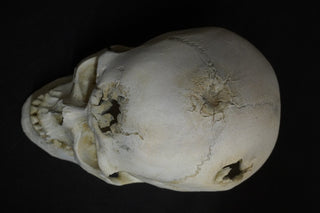 Blunt Force Trauma Lifecast Female Skull