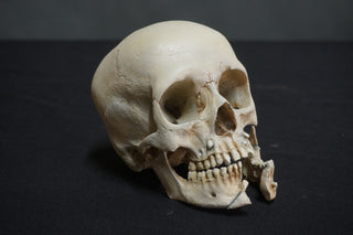 Juvenile Forensic Skull with Jaw Fracture