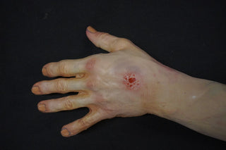 Substance Abuse Dura Jack Arm