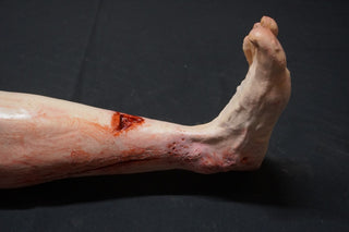 Vehicular Accident Dura Jack Leg