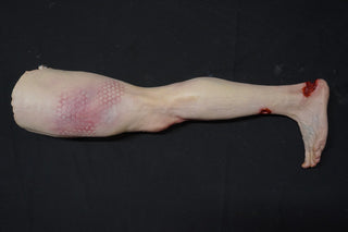 Vehicular Accident Dura Jack Leg