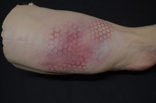 Vehicular Accident Dura Jack Leg