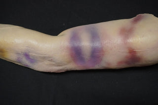 Blunt Force Trauma Pathology Dura Jack Arm with Body Connector