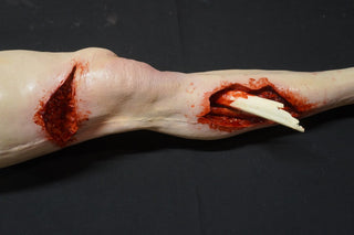Compound Fracture and Wound Packing Pathology Dura Jack Leg with Body Connector
