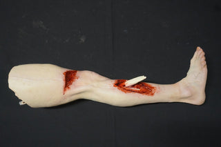 Compound Fracture and Wound Packing Pathology Dura Jack Leg with Body Connector