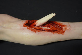 Compound Fracture and Wound Packing Pathology Dura Jack Leg with Body Connector